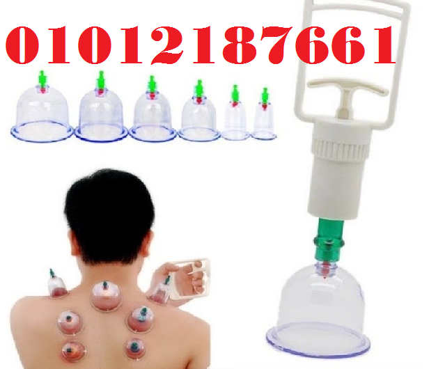 حجامة إسلامية طبية 6 قطع - لامتصاص السموم وتنشيط الدورة الدموية 01012187661